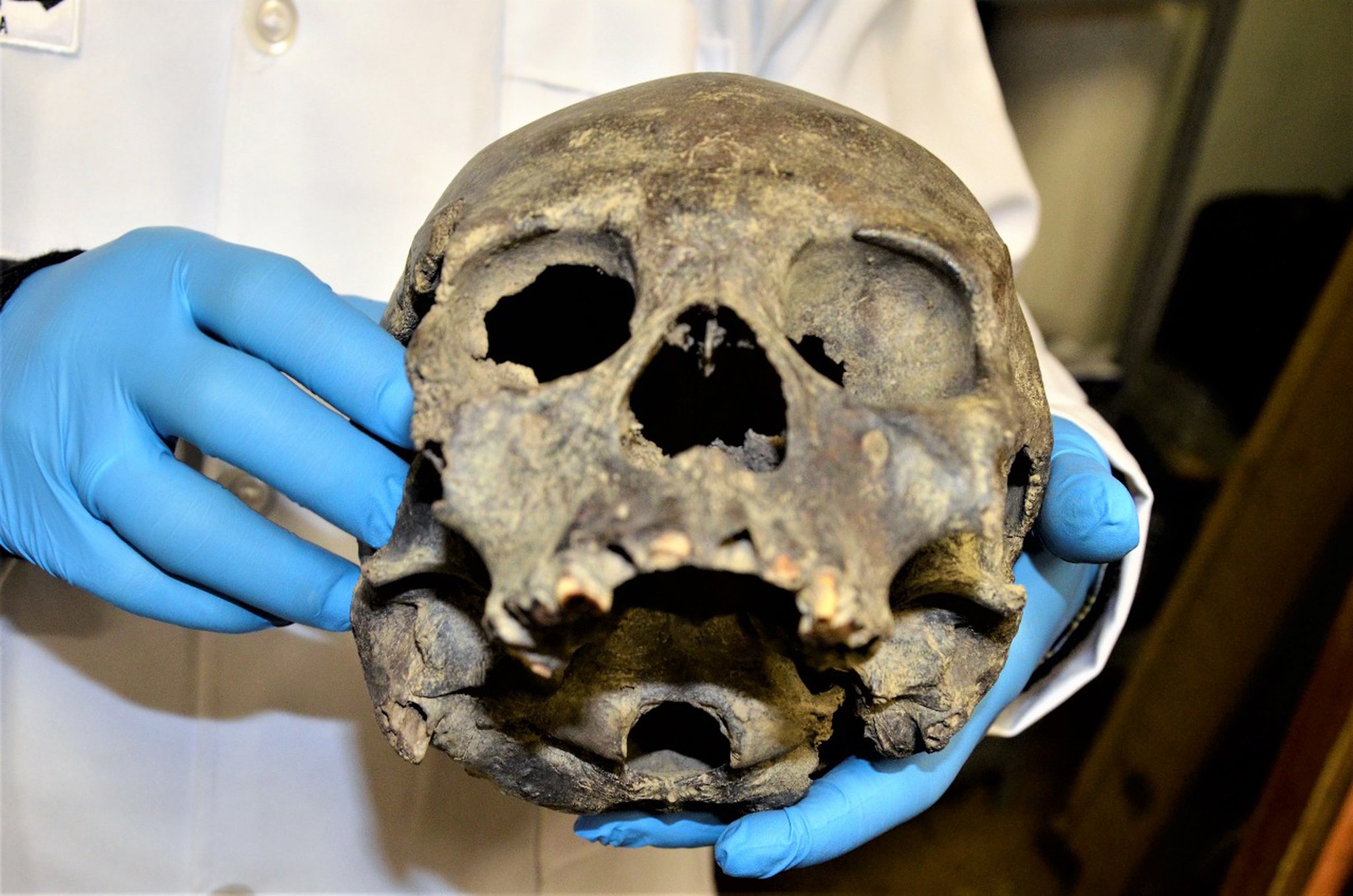 View of a human skull from the pre-Columbian Tiahuanaco culture at Bolivia's National Museum of Archaeology, in La Paz, Bolivia, April 8, 2018. EPA-EFE/BOLIVIAN CULTURES AND TOURISM MINISTRY