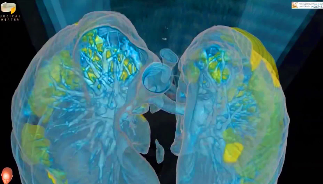 The image comes from a VR video developed by GWU's chief of thoracic surgery, Dr. Keith Mortman, and the Surgical Theater